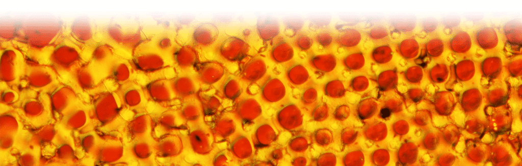 Orange and yellow microscopic photo of biocrystals